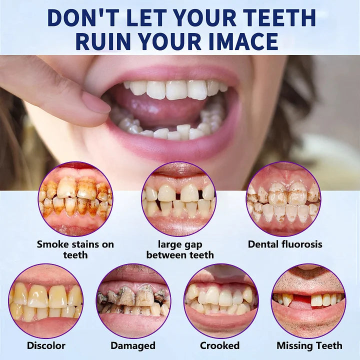 LOVILDSā¢š¦·Advanced Customized Full Denture Set𦷠(ā°Limited time discount last 30 minutesā°)