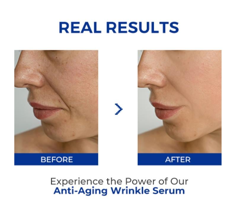 (🎁Last Day 49% OFF)🔥Anti-Aging Wrinkle Serum
