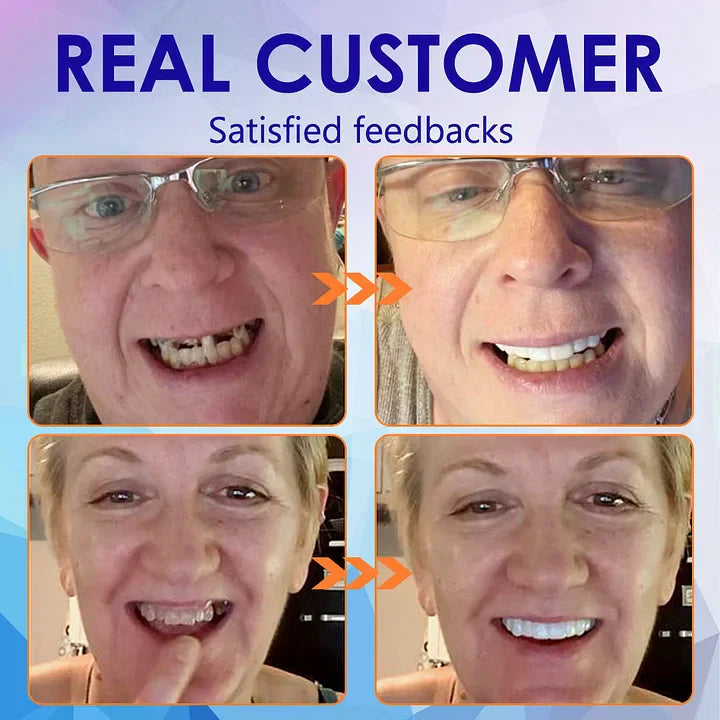 LOVILDSā¢š¦·Advanced Customized Full Denture Set𦷠(ā°Limited time discount last 30 minutesā°)