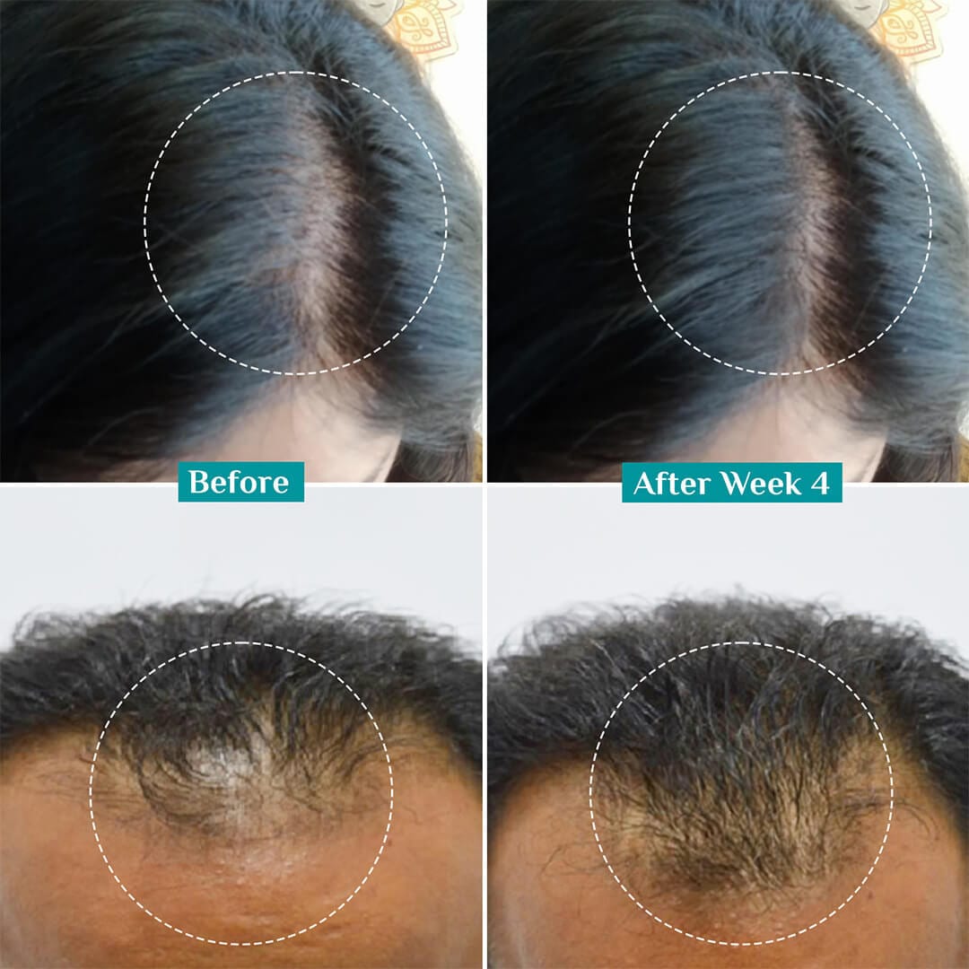 3% Redensyl + 4% Anagain Hair Growth Serum for Men