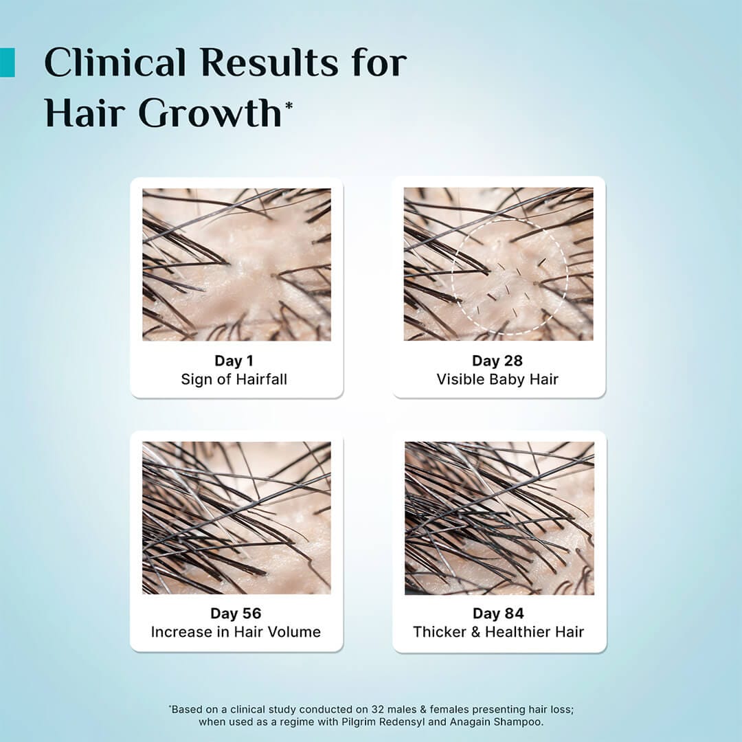 3% Redensyl + 4% Anagain Hair Growth Serum for Men