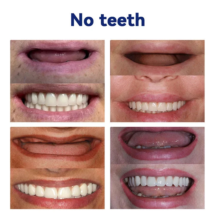 LOVILDSā¢š¦·Advanced Customized Full Denture Set𦷠(ā°Limited time discount last 30 minutesā°)