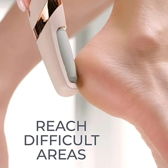 Electric Callus Remover – Get Baby Soft Feet at Home Instantly